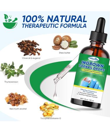 Ingrown Toenail Treatment Drops - Fast Acting Pain Relief & Softener 30ml - Buy Online on GoSupps.com