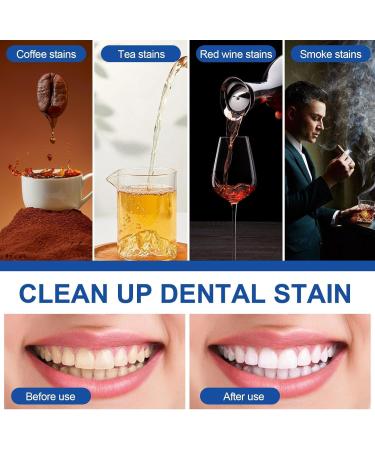 Professional Teeth Whitening Pen Red 2ml (6 Pack) - Buy Online on GoSupps.com