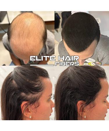 Elite Hair Fibers | All Natural Solution for Instantly Increasing Hair Density | For Men & Women | 27.5g (Medium Brown) - Buy Online on GoSupps.com