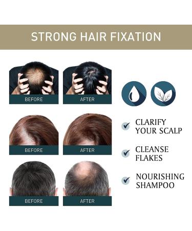 Sakura Japanese Shampoo and Conditioner Set Sakura Hair Growth Shampoo Sakura Japanese Shampoo & Conditioner Japan Evening Sakura Amino acid shampoo for Thickening Smooth Nourish Hair - Buy Online on GoSupps.com