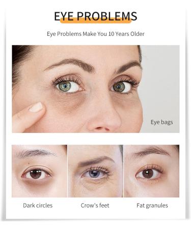  Fyearfly eye cream moisturizer 30ml arbutin eye cream moisturizer eye cream eye cream moisturizer eye cream remove dark circles for women - Buy Online on GoSupps.com