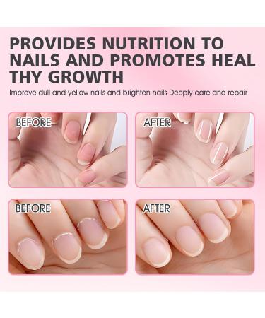 Huile Cuticules Ongles+Cuticule Ongle Remove+Kit de Dissolvant de Cuticules Adoucit les Cticules Elimine les Cellules Mortes Nourrit les Ongles et Favorise leur Croissance Saine 5 Pi ces - Buy Online on GoSupps.com