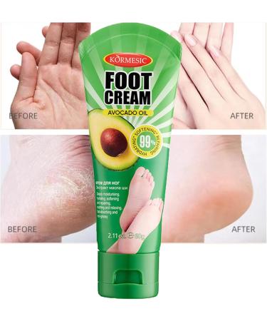 Foot Cream urea Foot Cream Avocado Foot Cream For Very Dry Feet Hydrating Hard Skin Remover Foot Cream Athletes Foot Cream Extra Strong Athlete Foot Cream Nourishing Dry Foot& Foot Skincare-Feet Cream - Buy Online on GoSupps.com