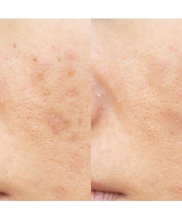 Skin Republic Glycolic Acid 10% Exfoliating Serum to visibly brighten refine tone and smooth skin texture (30ml) - Buy Online on GoSupps.com