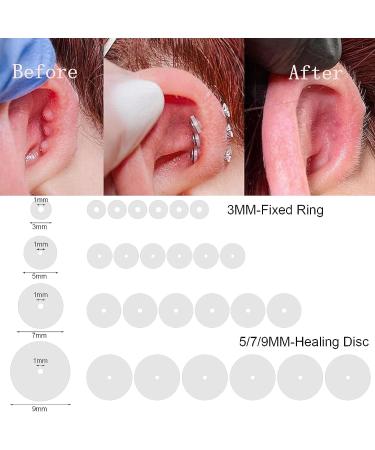 60pc Silicone Healing Piercing Discs for Bump Support - 3/5/7/9mm Clear Pads & Earring Backs - Buy Online on GoSupps.com