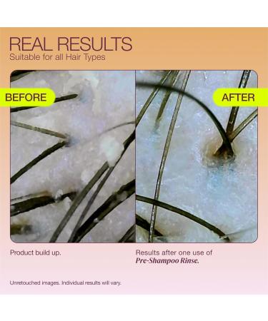 Pre-Shampoo Clarifying Scalp Treatment with AHA & Apple Cider Vinegar - 4oz | Healthy Scalp Solution - Buy Online on GoSupps.com