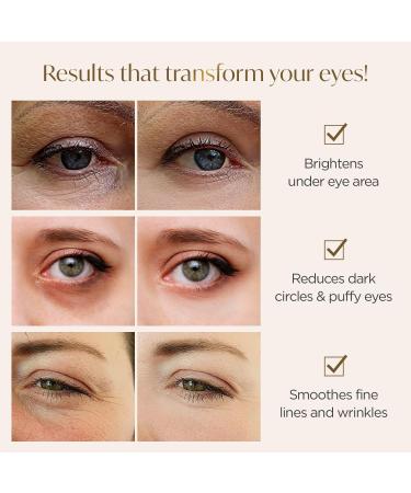 Plantifique 24K Gold Under Eye Masks - Anti Wrinkle Patches for Dark Circles & Puffiness (20 Pairs) - Buy Online on GoSupps.com