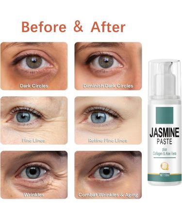 SEGMINISMART Jasmine Cream for Dark Circles Slip-On Eyelids Active Jasmine Ointment Jasmine Ointment Dark Circles 100 ml Jasmine Ointment for Dark Circles Makes Wrinkles and Dark Circles Disappear - Buy Online on GoSupps.com
