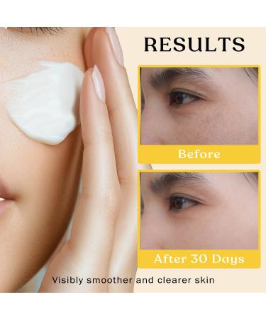 Beef Tallow Sun Balm for Skin - Moisturizer Cream - 100% Grass Fed Whipped Beef Tallow - Herb Infused - Supports Eczema Rosacea - Made in USA - Unscented - 2 oz Unscented with Zinc 2 Ounce (Pack of 1) - Buy Online on GoSupps.com