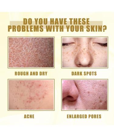 Scrub Oil | Skin Peeling For Body Brown Spots Skin Peeling For Body Brown Spots Natural Spots Whiten Yellow Peeling Oil Improve Skin Zorq - Buy Online on GoSupps.com