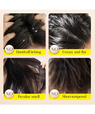  Beslibate Ginger Shampoo Ginger Shampoo Ginger Solid Shampoo Ginger Solid Shampoo Anti Hair Loss Shampoo Ginger Bar Shampoo Promote Hair Growth for Men Women 2 Pack - Buy Online on GoSupps.com