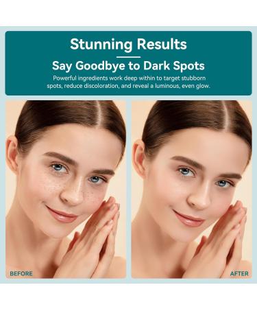 Dark Spot Remover for Face with 360 Roller Massage Ball Dark Spot Corrector Serum for face Fade Sun Spot Age Spot Brown Spot for All Skin Types 0.67 FL OZ Unscented - Buy Online on GoSupps.com