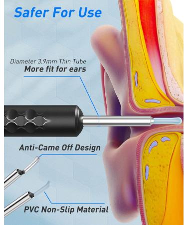 1080P HD Wireless Ear Wax Removal Kit with 6 LED Lights & 3 Curved Ear Spoons - WiFi Otoscope Camera for iPhone, Android, iPad - IP67 Waterproof Ear Scope - Ear Cleaner and Remover - Buy Online on GoSupps.com