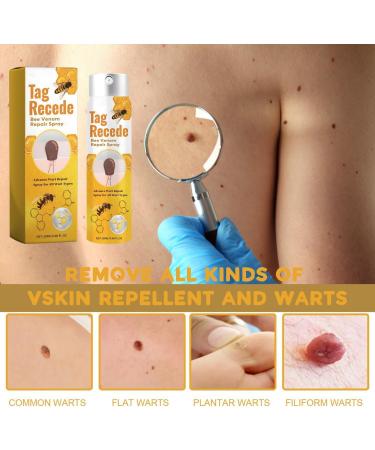 Shop Tag Recede Bienengift & Wart Removal Spray Effective Skin Treatment for All | International Shipping - Buy Online on GoSupps.com