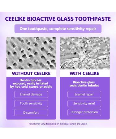 CEELIKE 5% Bioactive Glass Repair Toothpaste Advanced Enamel Protection Gentle Clean Glacial Camellia Flavor Fluoride-Free 100g (2) - Buy Online on GoSupps.com
