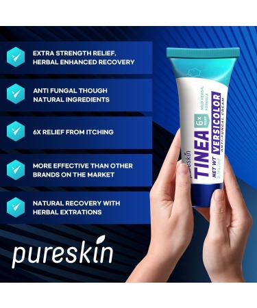 Tinea Versicolor Treatment Cream | Extra Strength Antifungal & Anti-Itch for Ringworm Athlete's Foot & Jock Itch | Natural Formula - Buy Online on GoSupps.com