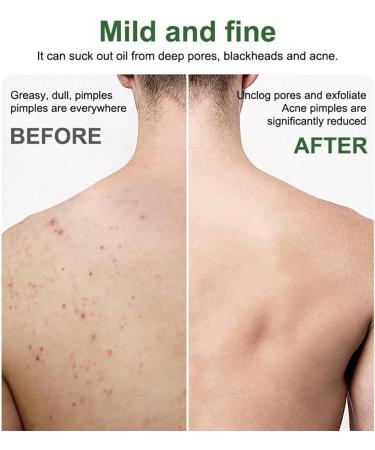 Men's Natural Moisturizing Body Soap Bar - Deep Cleanse and Hydrate Skin - Oil Control and Pore Refinement - 1PCS - Buy Online on GoSupps.com