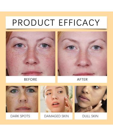 Crsetmyth 2 pieces vitamin C essence for face essence vitamin C for skin moisturizing nourishing facial serum with vitamin C skin lightening and firming essence plumps the skin - Buy Online on GoSupps.com