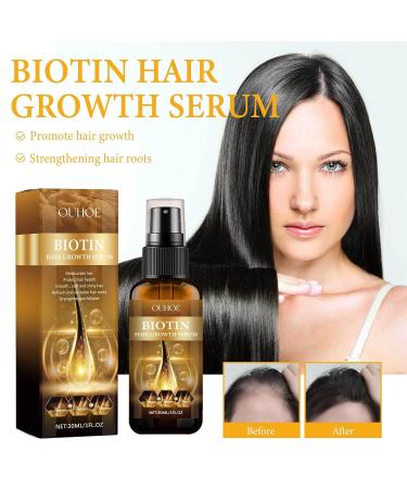 Buy Biotin Hair Growth Spray - 30ml Essential Oil for Fast Hair Growth & Skin Care | Multicolor International Shipping - Buy Online on GoSupps.com