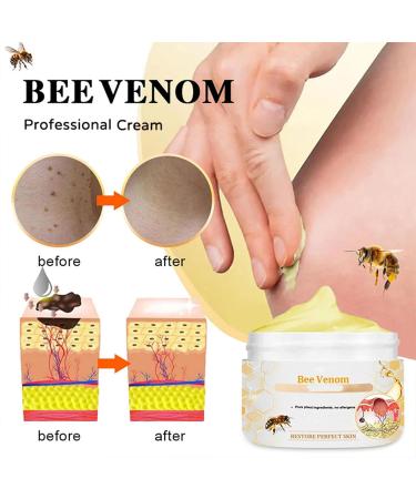 Bee Venom Cream Professional Bee Venom Cream Bee Venom Repair Cream for All Parts of The Body (2 Pack) - Buy Online on GoSupps.com
