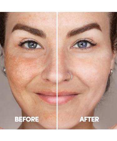 ZENMED Free and Clear Combo - Omegaceramide Gentle Cleansing Cream Support Serum & Facial Cleansing Gel - International Shipping Available - Buy Online on GoSupps.com