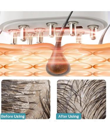 Hair Oil Applicator - Scalp Machine Vibrating Electric Applicator Comb Machine Waterproof for Anti Frizz and Relieving Stress - Buy Online on GoSupps.com