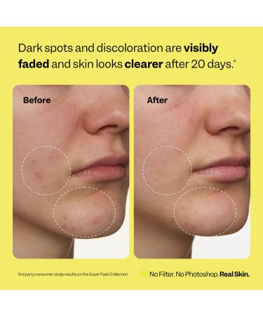 Peach Slices - Super Fade Discoloration Serum for Face (1.01 oz) - Dark Spots Hyperpigmentation Uneven Skin - Niacinamide Serum - Tranexamic Acid - Vegan & Cruelty Free - Korean Skin Care & Beauty - Buy Online on GoSupps.com