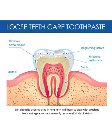 1/2/3 Pcs Loose Teeth Care Toothpaste Gochicgolden Repair Toothpaste Teeth Whitening Toothpaste Anti-Cavity Teeth Cleaning Tooth Stains 120g (A 1 Pcs) - Buy Online on GoSupps.com