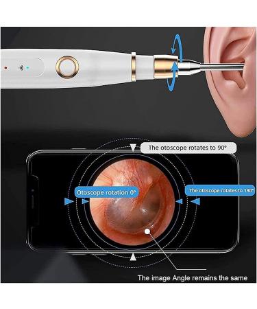 QIYUDS Ear Wax Removal Tool Ear Cleaner Ear Wax Removal Kit 3.9mm Smart Visual Ear Spoon Ear Endoscope high-Definition WiFi All-in-one Otoscope - Buy Online on GoSupps.com