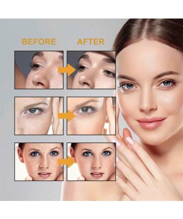 Buy Achromin & Pigmanorm Creams | Best Multi-Purpose Face Moisturizer for Brightening & Hydration - International Shipping Available - Buy Online on GoSupps.com