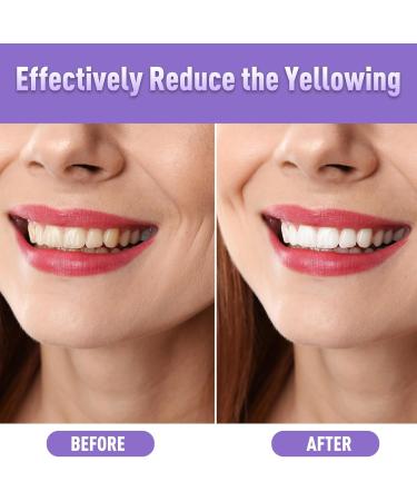 Teeth Whitening Pen (4 Pcs) - Effective Stain Removal Painless Travel-Friendly Mint Flavor | 40+ Uses - Buy Online on GoSupps.com