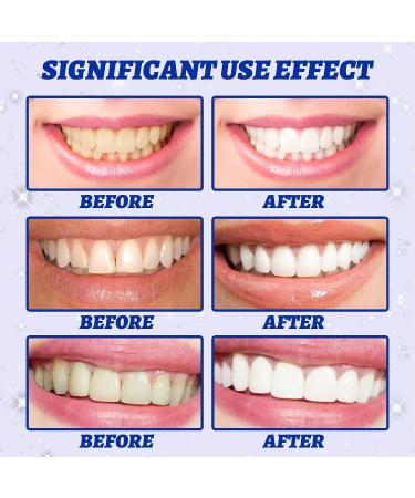 Professional Strength Teeth Whitening Strips - 14 Strips/7 Treatments - Reduce Sensitivity, Remove Stains - Brighter, Confident Smile - Buy Online on GoSupps.com