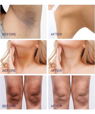 PEPHUCA Dark Spot Corrector Cream Underarm Cream for Face and Body Neck Armpit Knees Elbows Private Areas Intimate Areas Legs Bikini Line 80g White 5 cubic_centimeters - Buy Online on GoSupps.com