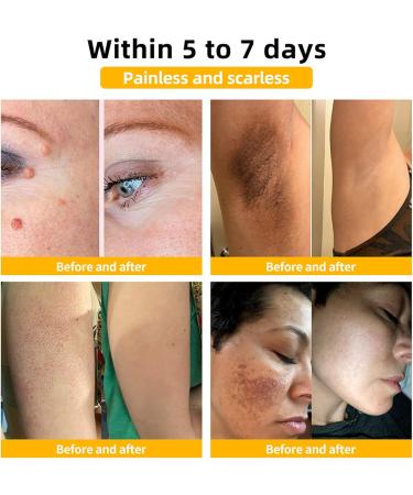 Bee Venom Skin Treatment Cream Bee Venom Comprehensive Cream Professional bee venom cream for Men&Women (1) - Buy Online on GoSupps.com