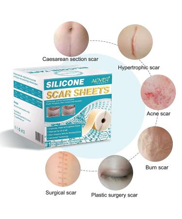 Medical Grade Silicone Scar Sheets - 1.6x120 Inch (7 Month Supply) for Surgery, C-section, Keloid & Burn - Safe & Painless Scar Removal - Buy Online on GoSupps.com
