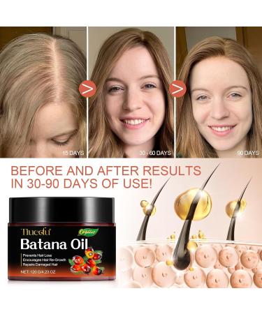  CCKULOOB Batana Oil for Hair Growth Batana Hair Oil 100% Pure and Natural Batana Oil for Hair Growth Eliminates Split Ends Restores Damaged Hair 120g - Buy Online on GoSupps.com