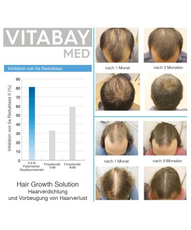 Vitabay Hair Growth Solution 70ml | Effective Serum for Hair Loss | Hair Thickening & Growth for Men & Women - Buy Online on GoSupps.com