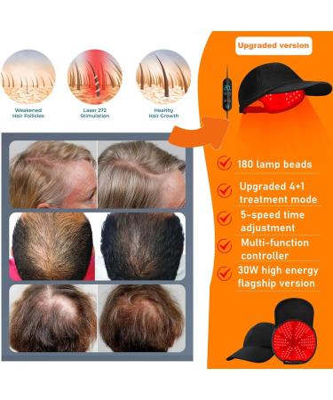 Red Light Therapy For Hair Growth|Red Light Hair Growth System|Hair Loss In Men & Women|Advanced Hair Regrowth System|Red Light Therapy Cap - Buy Online on GoSupps.com