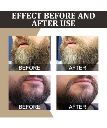 100% Natural Beard Oil for Men | Organic Argan & Jojoba | Moisturizing & Strengthening | Calming Formula - Buy Online on GoSupps.com