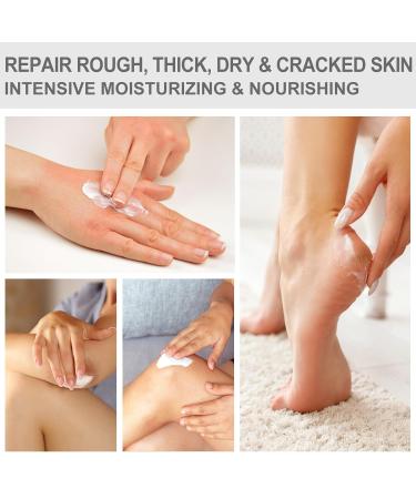 Urea Cream 40% - Pro Foot & Hand Cream for Dry Cracked Skin Moisturizing Urea Lotion for Heels Knees & Elbows - 5.29 oz - Buy Online on GoSupps.com