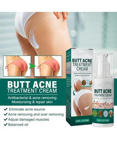 Cr me Nettoyante Acn Fesses et Cuisses Cr me pour les Boutons des Fesses Nettoyage Cr me Dissolvant de Boutons pour les Fesses 100ML 1PC - Buy Online on GoSupps.com