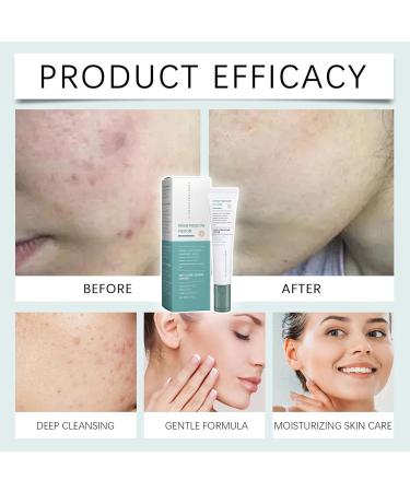 Moisturizing Cream | Skin Barrier Repair Cream - Soothing Repairing Moisturizing Lotion for Dry Sensitive Skin Reduces Imperfections Brightens Skin Controls Oil on Face and Body Women Men - Buy Online on GoSupps.com