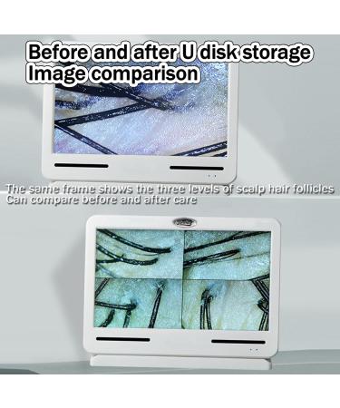 Scalp Hair Follicle Detector Professional Skin Diagnostic Hair Analyzer Scalp Microscope Skin Moisture Analyzers Skin Diagnosis Scanner Provides Clearer Detection - Buy Online on GoSupps.com