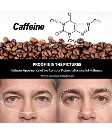 Open Eyes Awaken Peptide Lifting Eye Gel - Anti-Wrinkle Firming Treatment (2pcs) - Buy Online on GoSupps.com