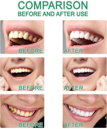 Easilyous Bright White Toothpaste Strictrigid Niacinamide Whitening Toothpaste Bright White Fresh Breath Toothpastes Remove Tooth Stains (1PCS) - Buy Online on GoSupps.com