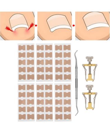 9Pcs Ingrown Toenail Corrector Strips Ingrown Toenail Treatment Strips Brace Foot Care Tool Kit Paronychia Toe Nail Fixer Pedicure Tool Nail Toenail Corrector Sticker Nail - Buy Online on GoSupps.com