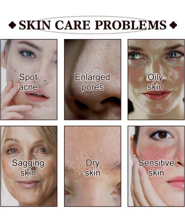 Azelaic Acid Serum Cream Azelaic Acid 12% Facial Serum Hydrating Serum with Vitamin C for Acne Redness Dark Spot Anti Aging Serum for Face Face Skin Care Beauty Brightening Serum for All Skin Types - Buy Online on GoSupps.com