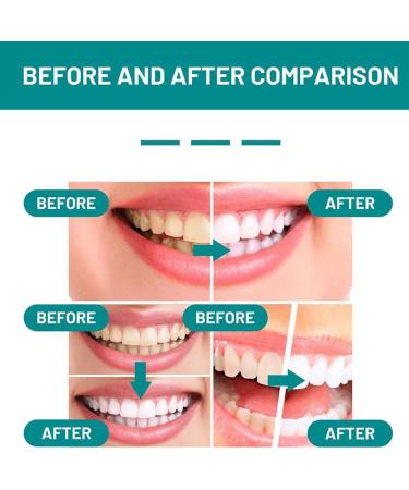 Furzero Smartsmile Mouthwash - Tooth-Rebuilding Deep Cleaning & Refreshing Breath - Total Teeth Care (1PC) | Shop Internationally - Buy Online on GoSupps.com
