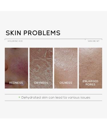 Travel Size Skin Care Set | Hyaluronic Acid Skincare for Women | TSA-Friendly 3pcs Moisturizer Serum & Eye Cream for Hydrated Skin - Buy Online on GoSupps.com