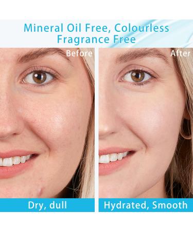 50g Hydro Boost Hyaluronic Acid Moisturizing Water Gel - Lightweight Face Moisturizer for Oily Skin | Long-lasting Hydration - Buy Online on GoSupps.com